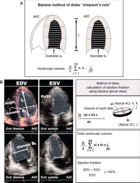 simpson's method pericardial volume.